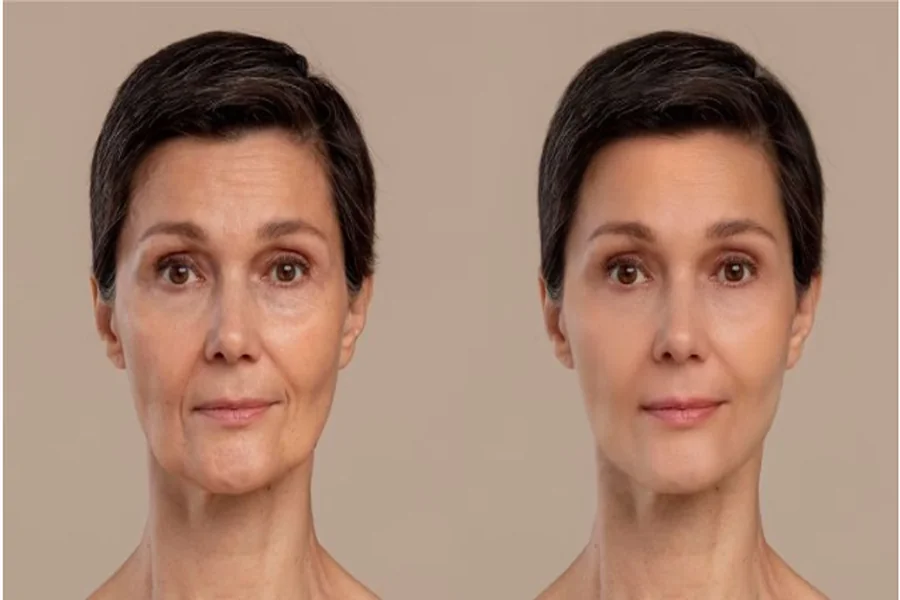 Facelift Tourism