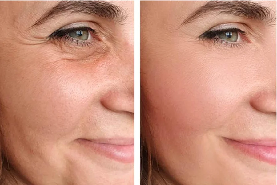 Facelift Tourism