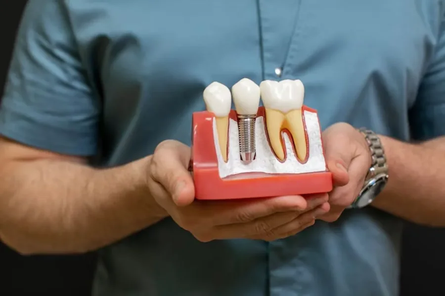 Implants