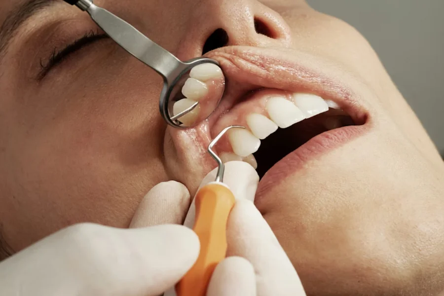 Dental Restoration