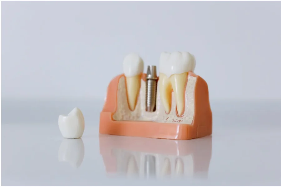 Dental Crowns