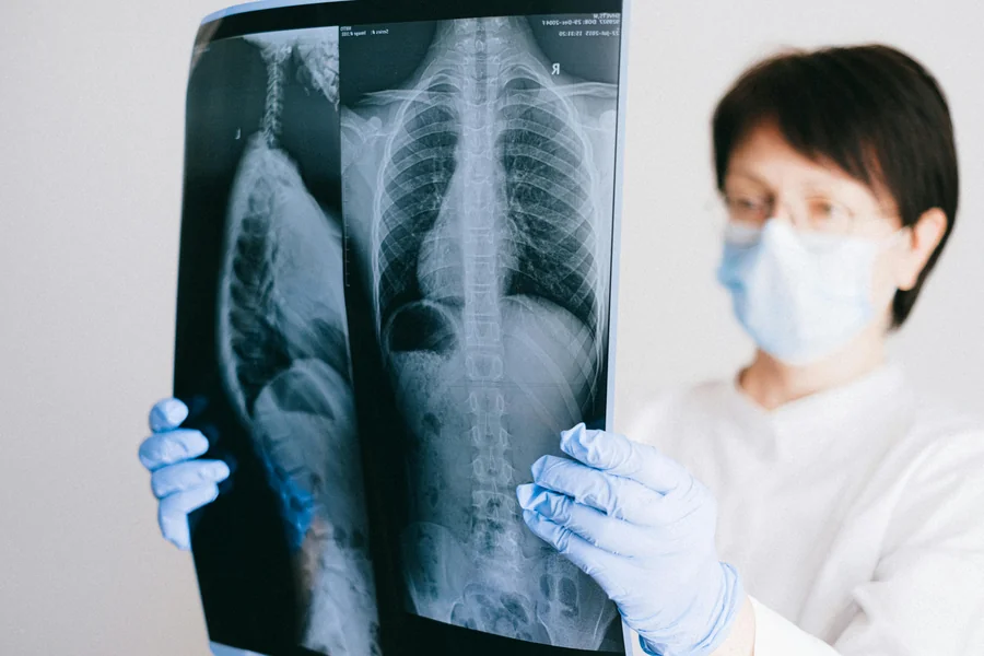 Lung cancer